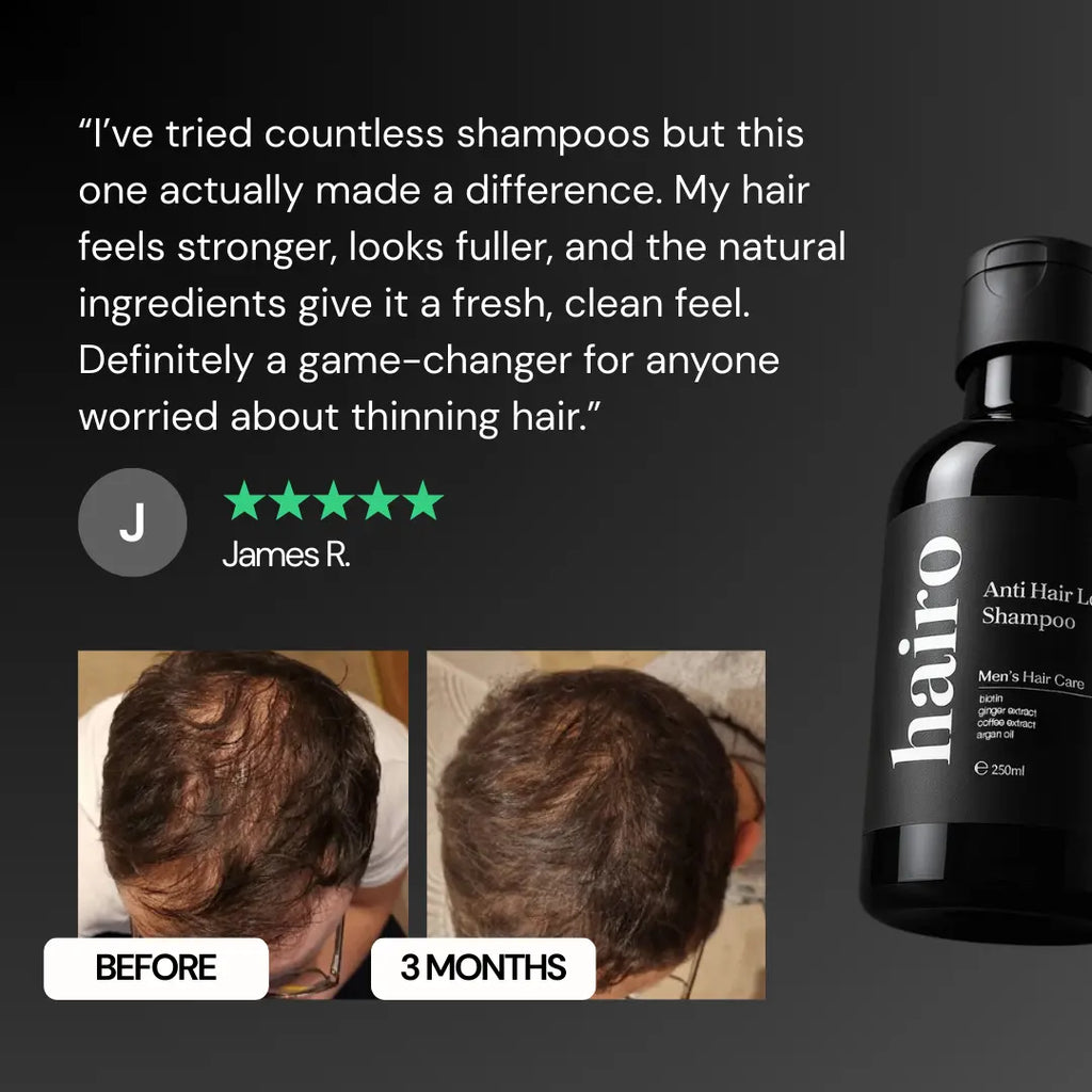 Anti Hair Loss Shampoo