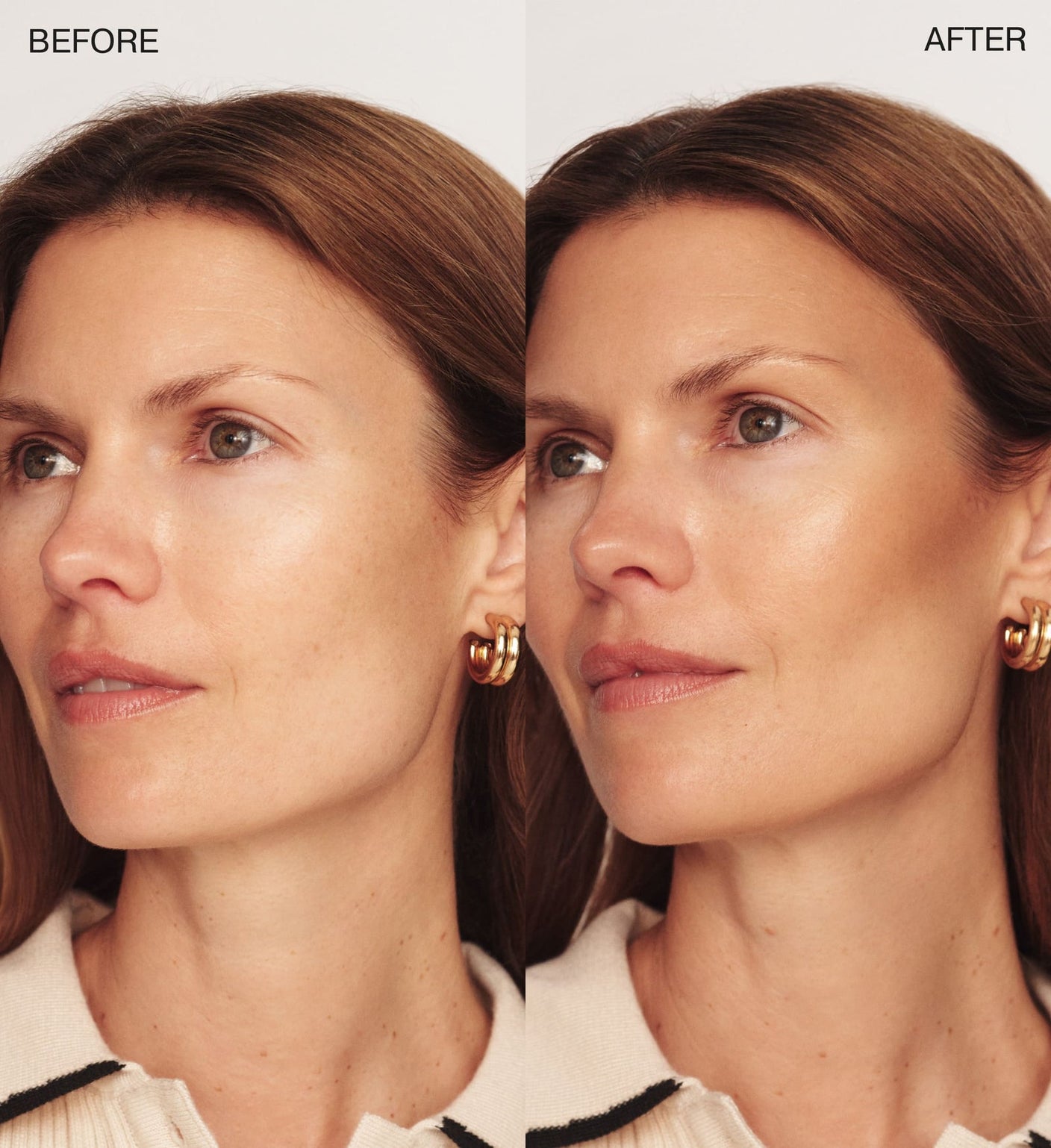 The Soft Tan Bronzer before and after comparison showing a natural sun-kissed glow from the All-in-One Bundle.